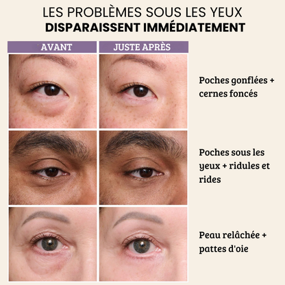 FirmX Easy-Wear Crème anti-rides pour les yeux