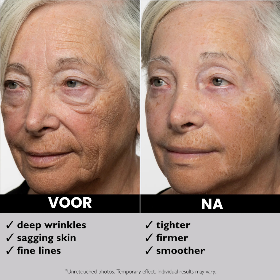Instant FIRMx Anti-rimpel Gezichtscreme