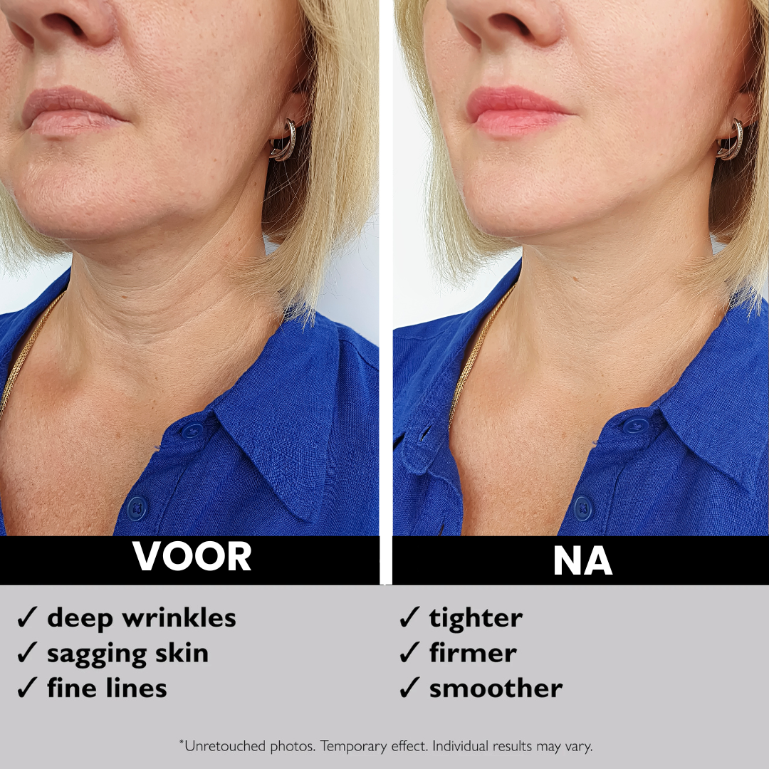 Instant FIRMx Anti-rimpel Gezichtscreme
